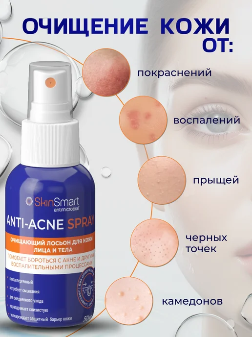 SkinSmart Тоник для лица, средство от прыщей и акне, 50 мл, фото 6