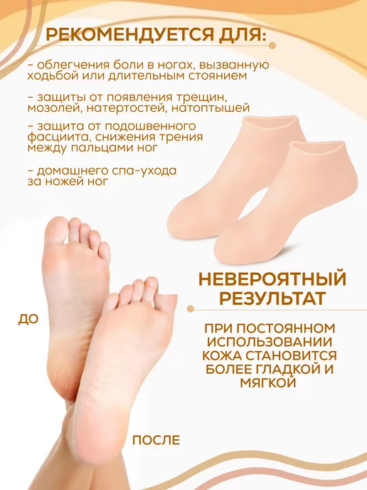 Силиконовые носочки косметические, вариант, фото 4