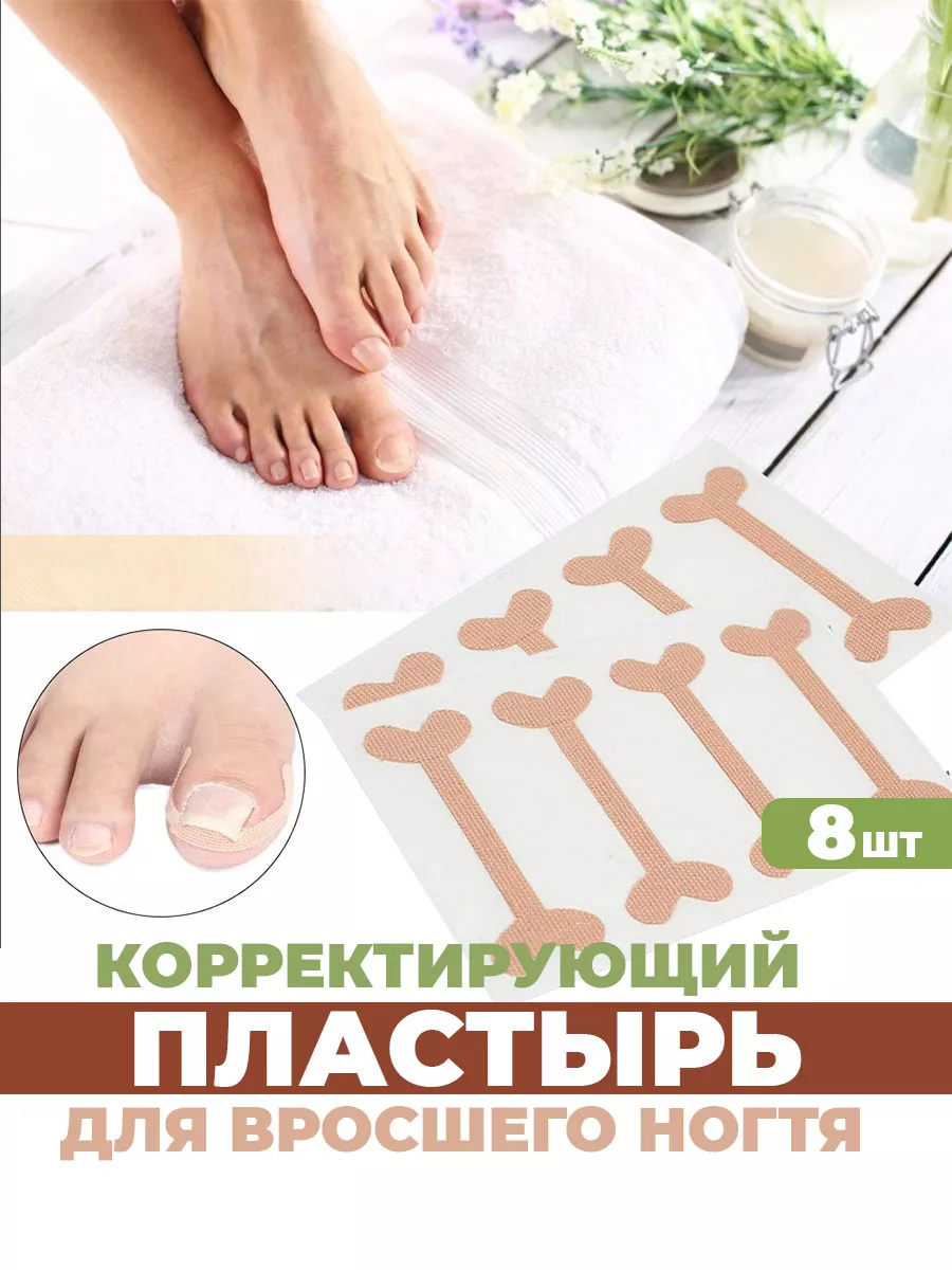 От вросшего ногтя пластырь корректор, от врастания на пальце