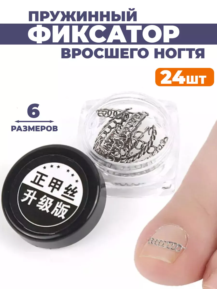 Корректор для вросшего ногтя скобы