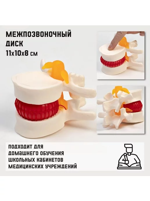 Развивающие игрушки для детей Макет "Межпозвоночный диск", наглядный материал, 11х10х8 см, 10x8 см, фото 2
