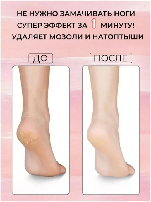 JIMMI Нано пилка для пяток, вариант, фото 2