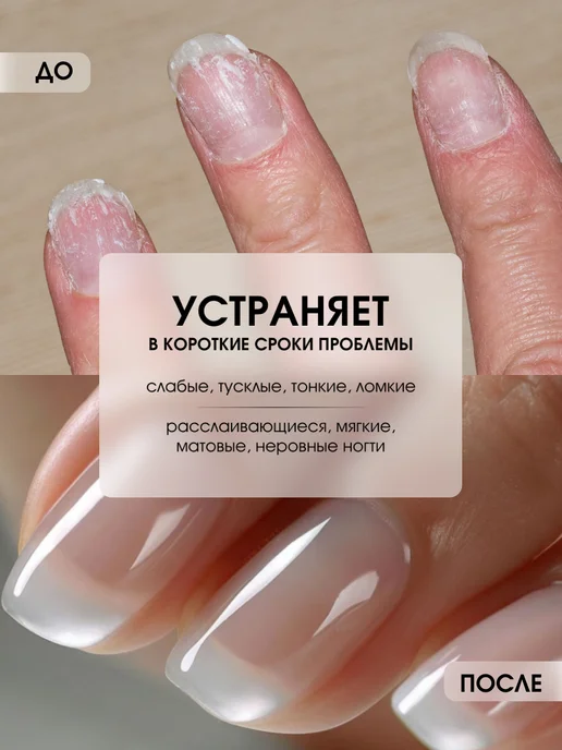 KIKI Укрепляющий лак для ногтей лечебный прозрачный 8в1 10мл, 10 мл, фото 2