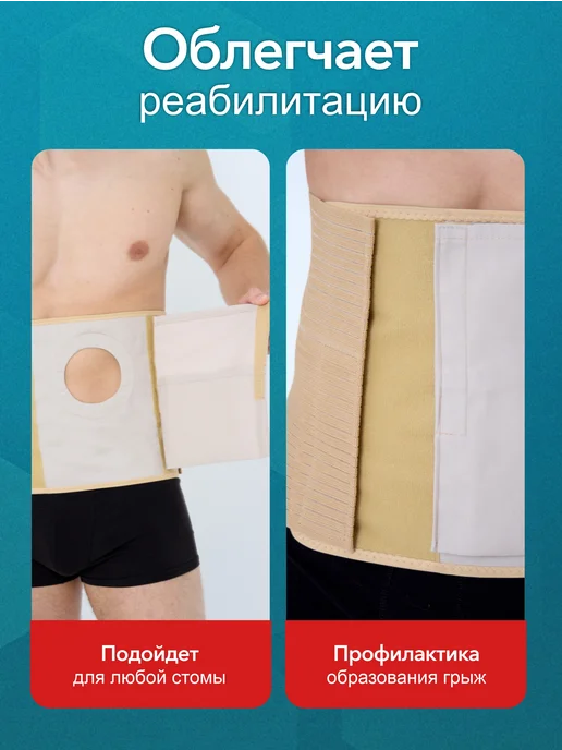 Liskera Бандаж послеоперационный для стомы, бежевый, фото 7