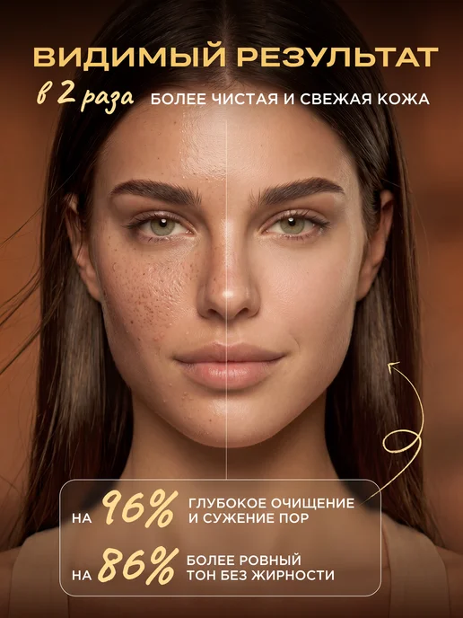 HELDI Гель для умывания лица от прыщей, вариант, фото 4