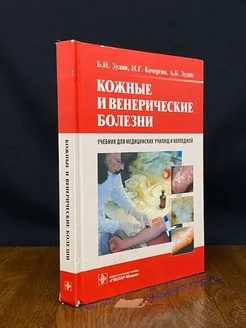 Кожные и венерические болезни