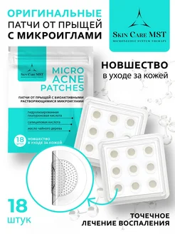 Патчи от прыщей с микроиглами Skin Care NG 227269357 купить за 795 ₽ в интернет-магазине Wildberries