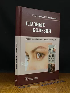 Глазные болезни