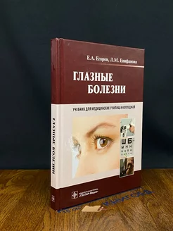 Глазные болезни