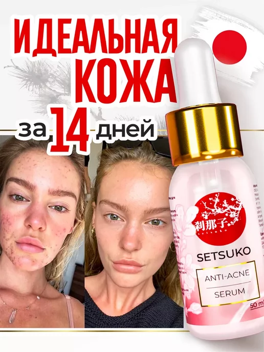 SetSuko Anti-Acne Сыворотка для лица от прыщей и черных точек с ниацинамидом