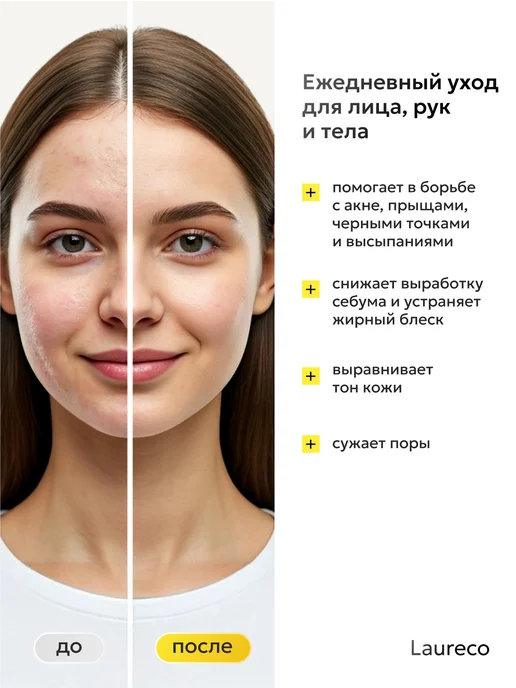 Laureco Мыло от прыщей для лица и тела серное, вариант, фото 3