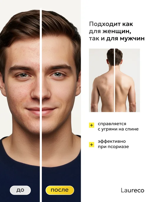 Laureco Мыло от прыщей для лица и тела серное, вариант, фото 4