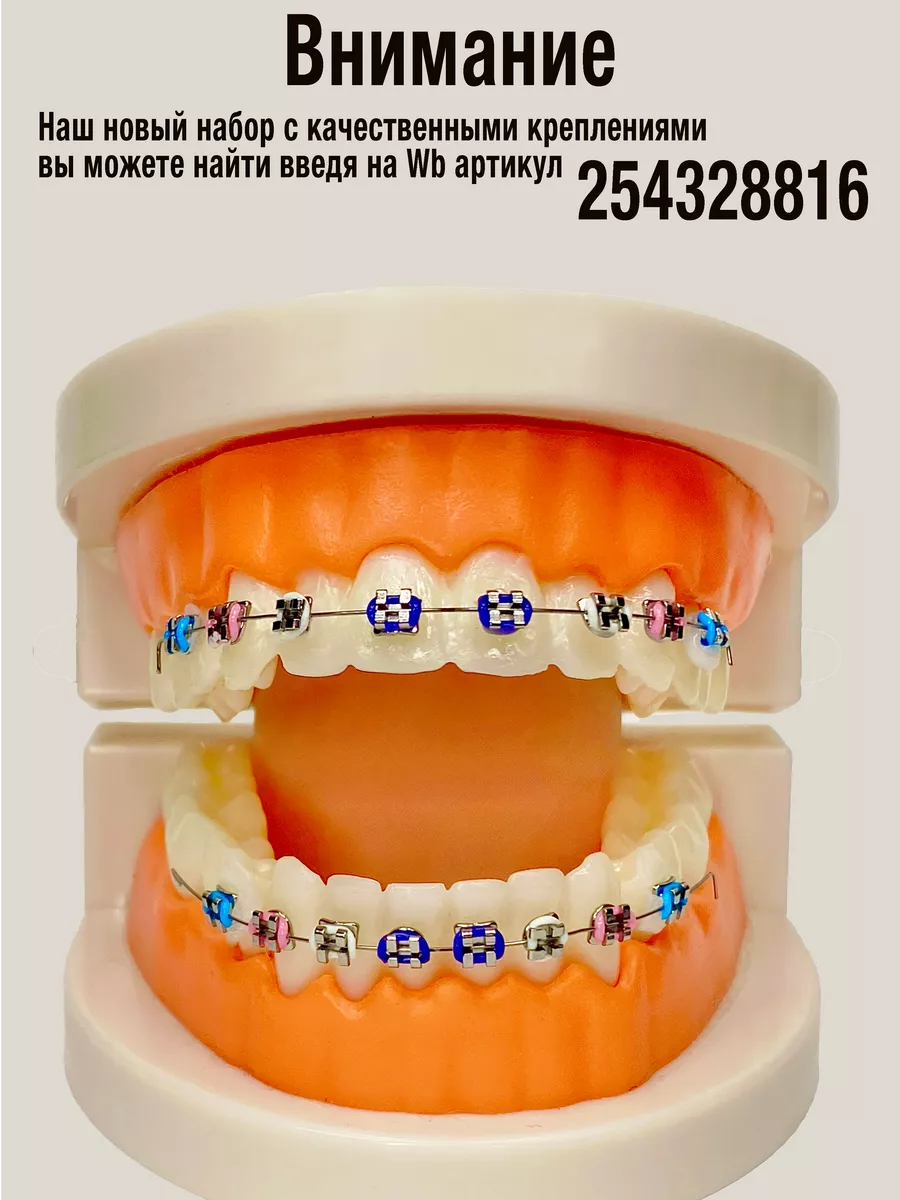 Брекеты накладные металлические для зубов. Комплект скайсы Зубоф 235275464  купить за 940 ₽ в интернет-магазине Wildberries