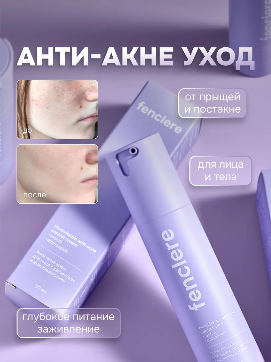 Крем от прыщей для лица