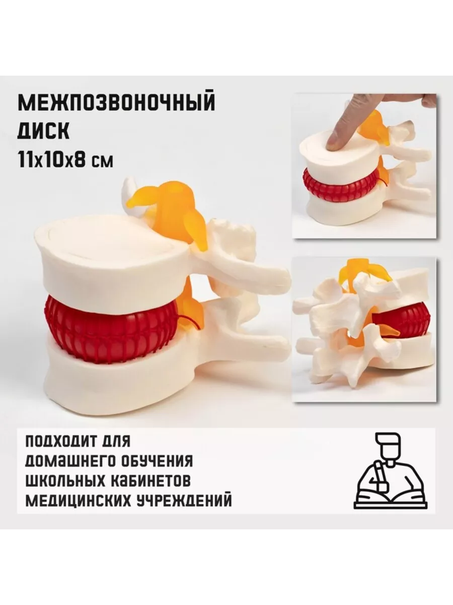 Модель межпозвоночного диска 11x10x8 см